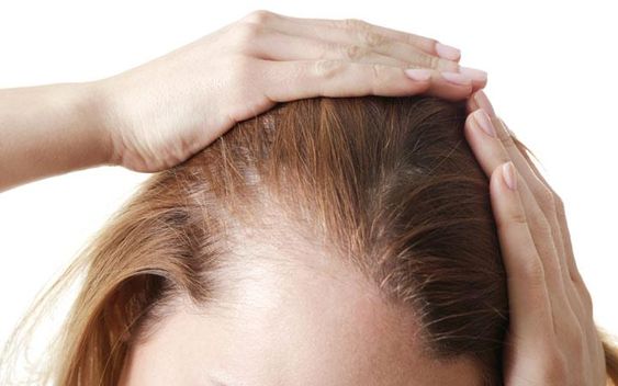 Infected Hair Follicles Could Cause Hair Loss