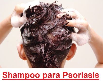scalp psoriasis shampoo-type