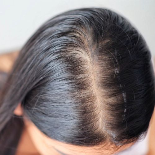 Tips to Fight Hair Loss When Over 40