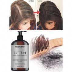 7 Best Biotin Shampoos for Hair Growth That Actually Work 2022