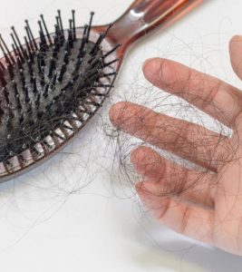 what is the cause of hair loss